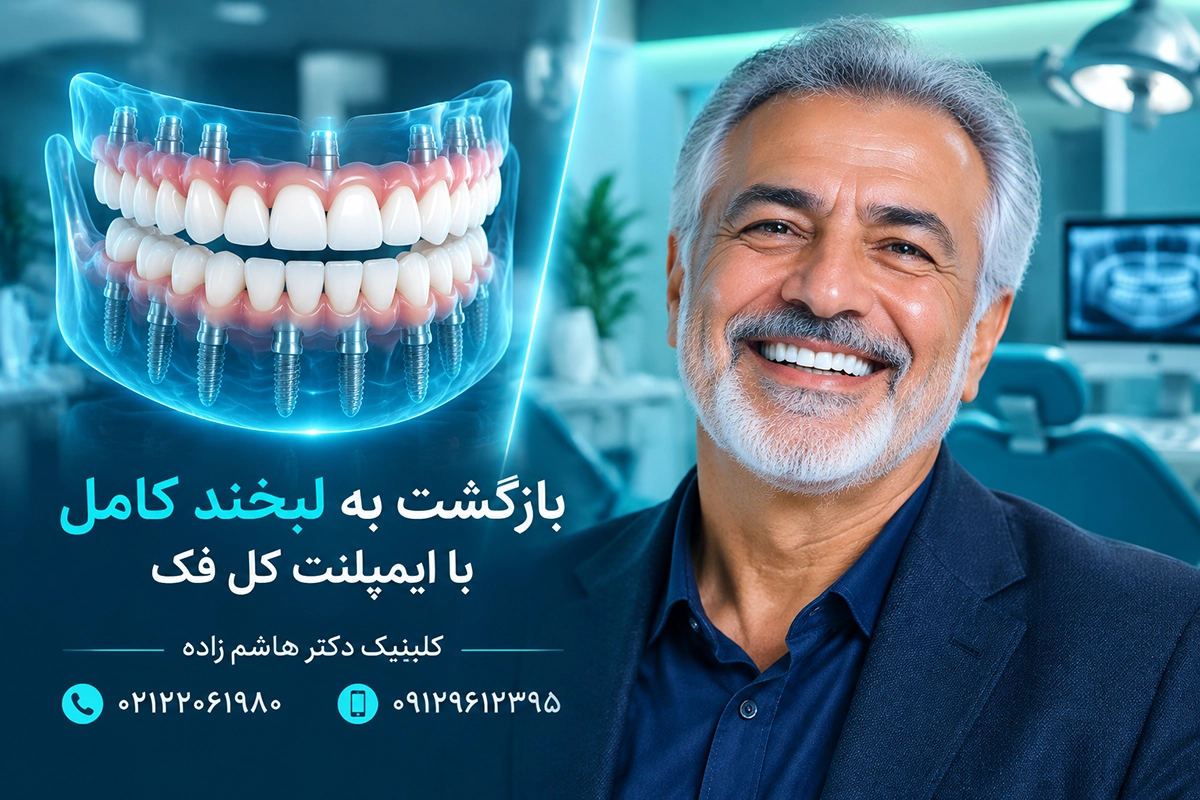کاشت ایمپلنت‌های متعدد در فک