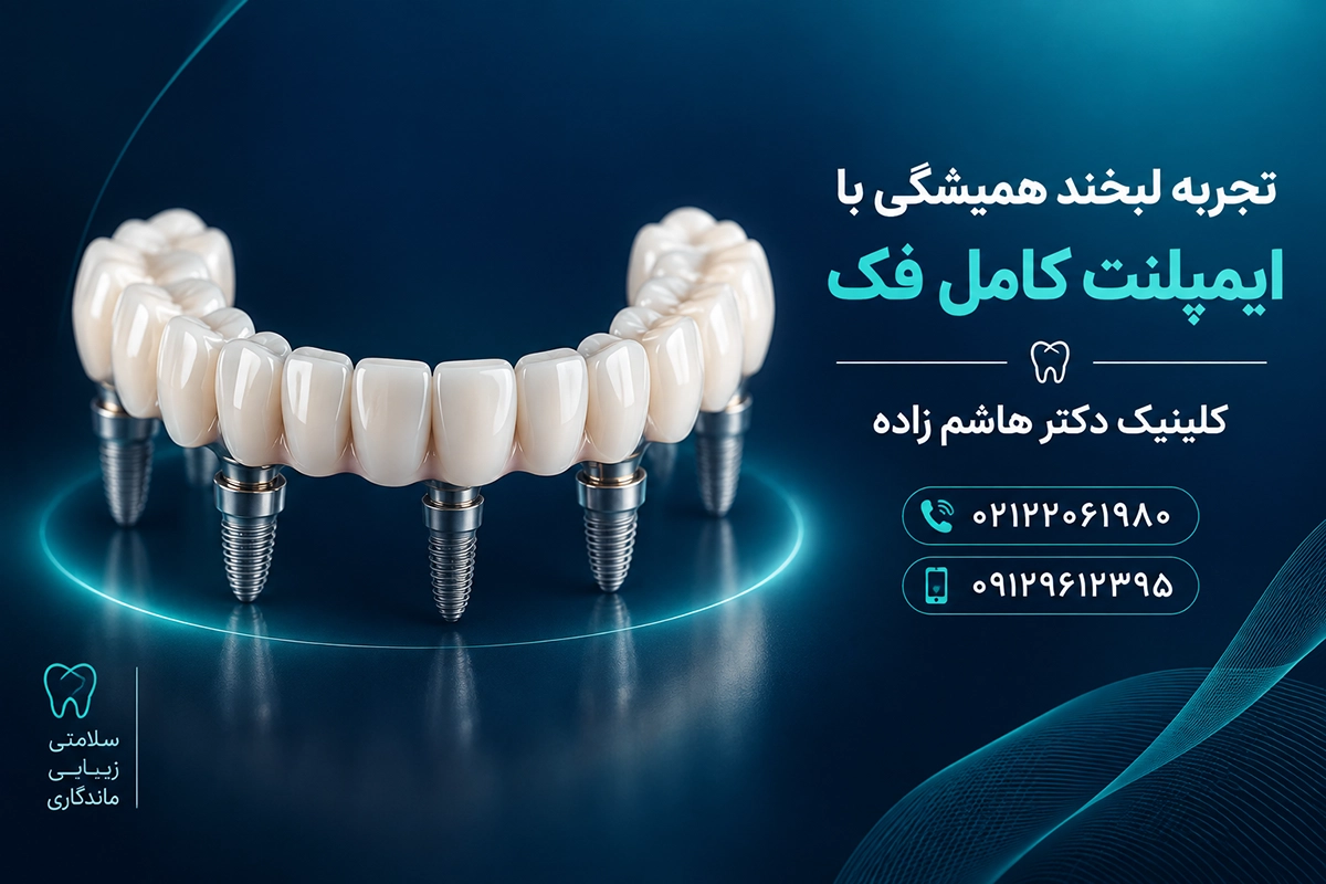 ایمپلنت کامل فک بالا و پایین